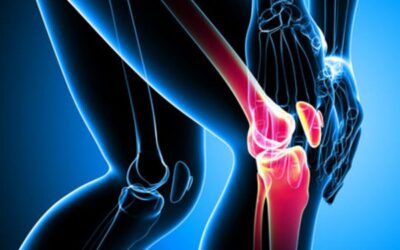 Arthrose : les bons réflexes