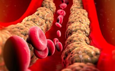 Cholestérol : le grand bluff de la médecine !