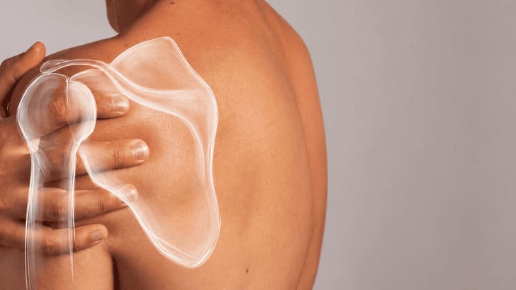 douleur à l’épaule avec illustration anatomique pour expliquer une blessure musculaire ou articulaire