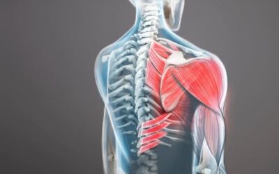 Douleurs trapèzes : causes et solutions