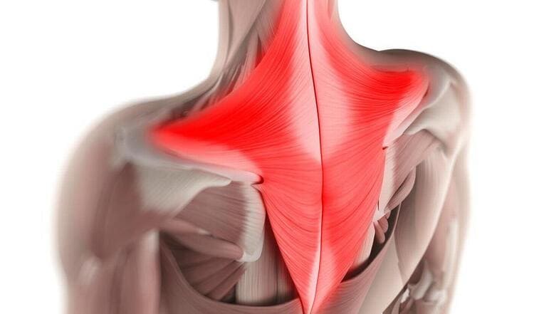Anatomie du muscle trapèze liée aux douleurs cervicales et tensions musculaires